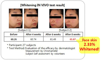Whitening in VIVO